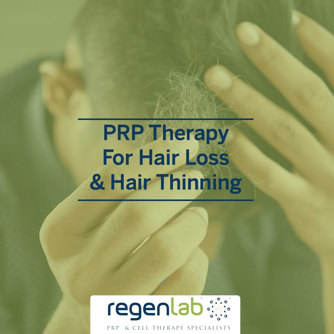 PRP for Hair Loss