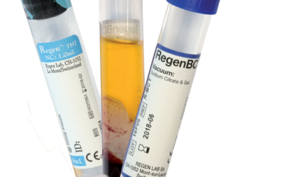 What is PRP?