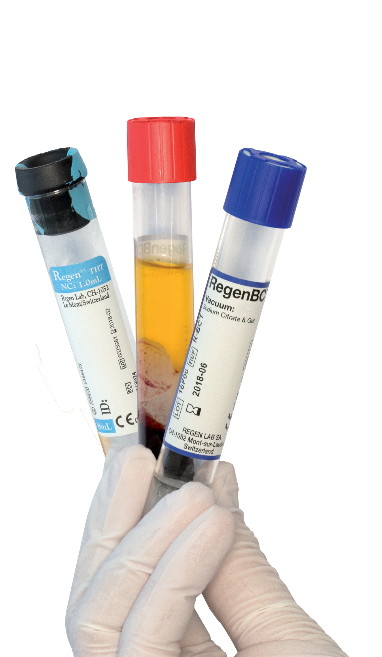 what is PRP?