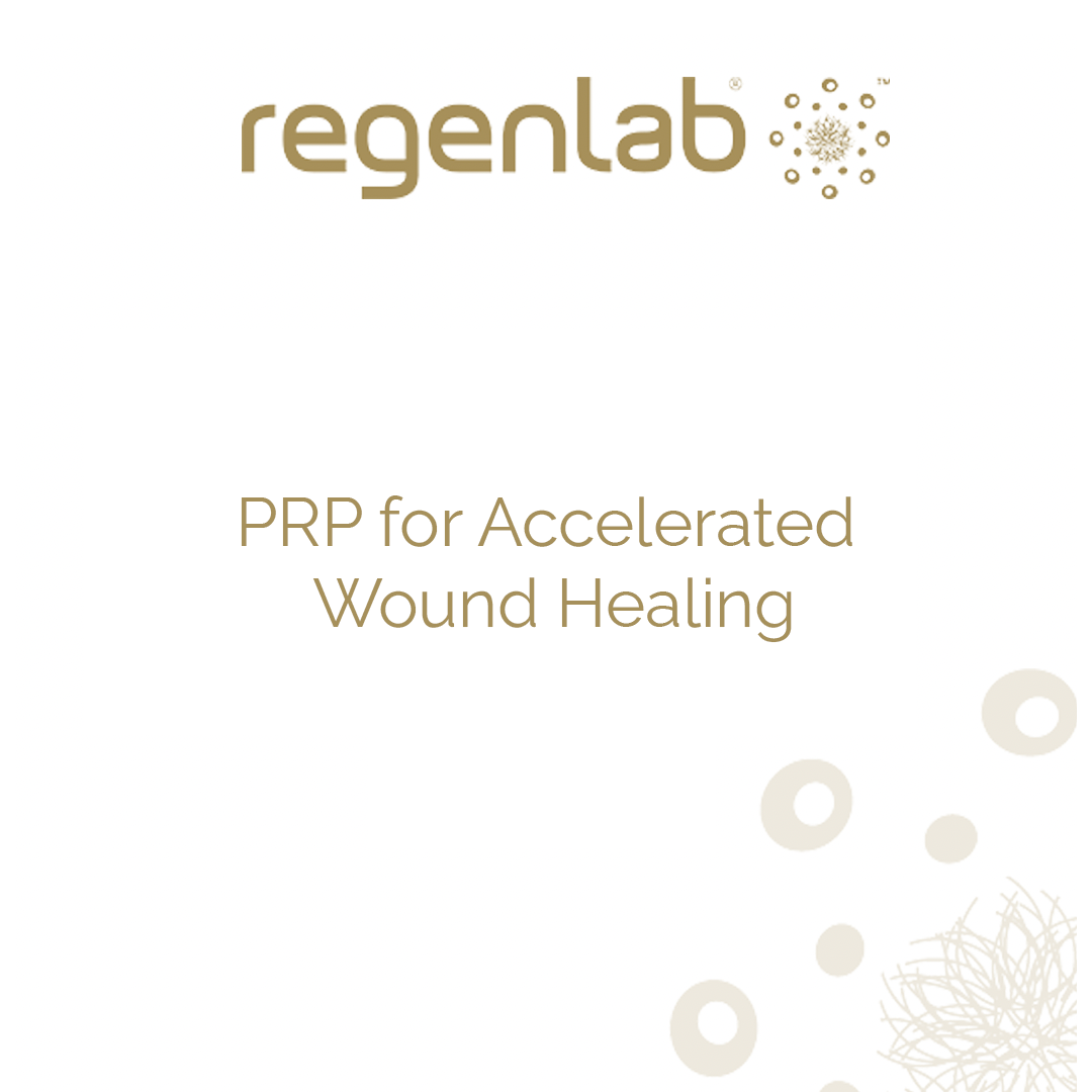 PRP for Accelerated Wound Healing