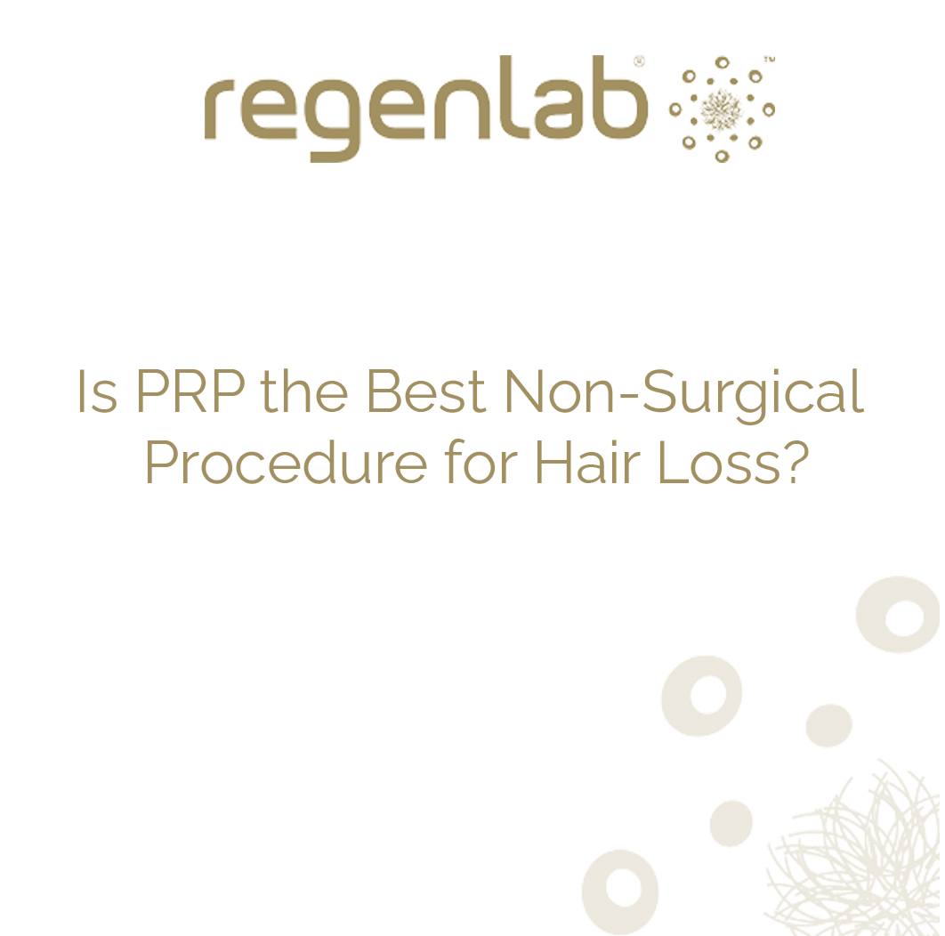 Is PRP the Best Non-Surgical Procedure for Hair Loss?