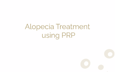 Alopecia Treatment using PRP