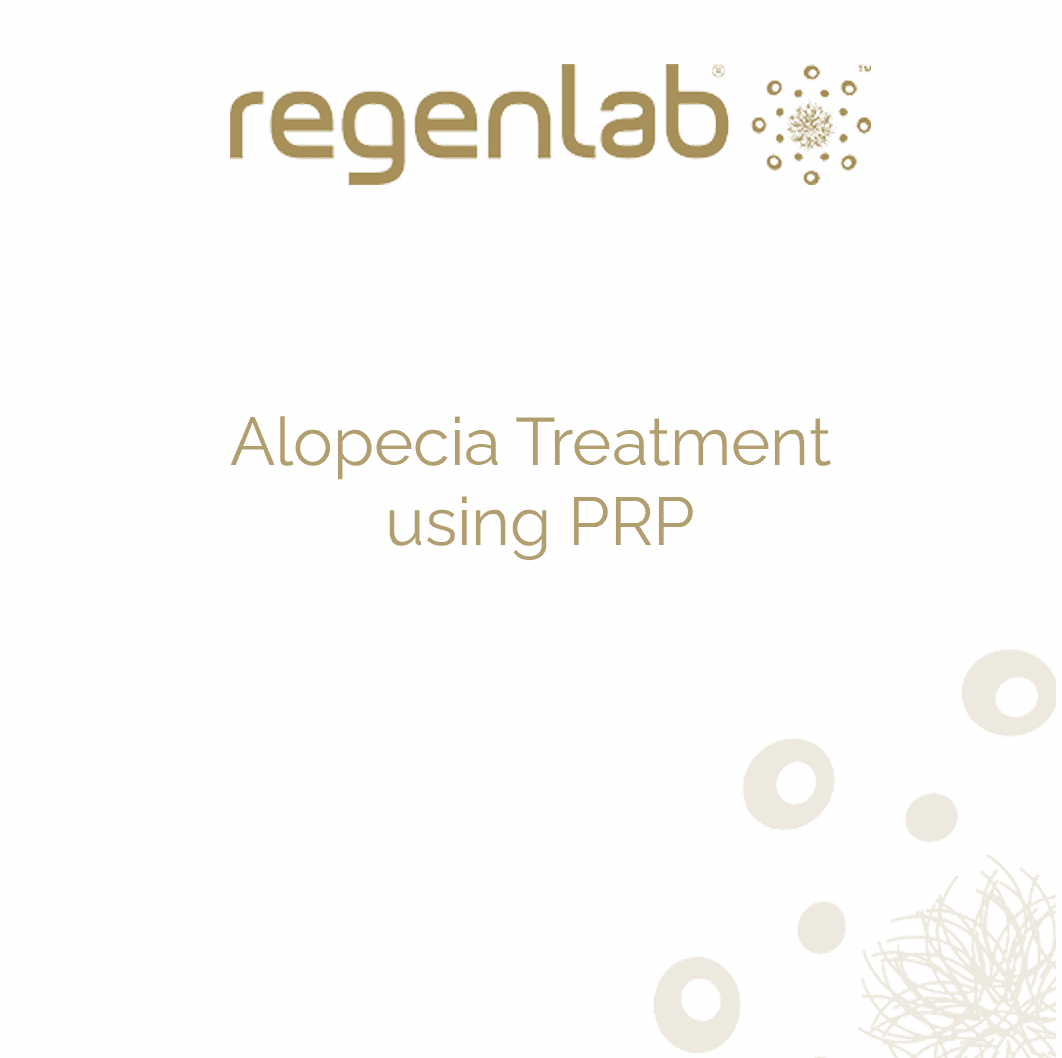 Alopecia treatment using prp