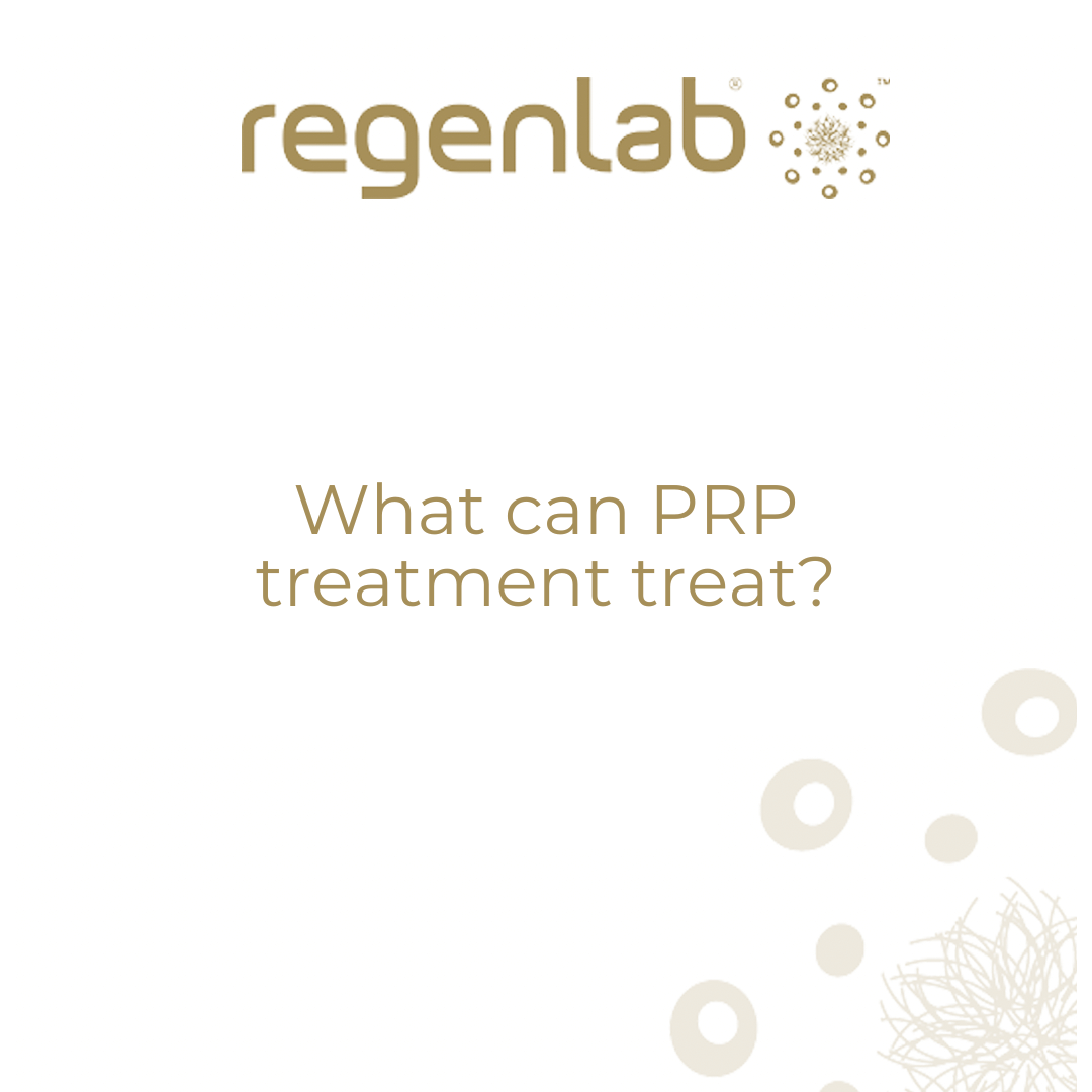 What can PRP treatment treat?