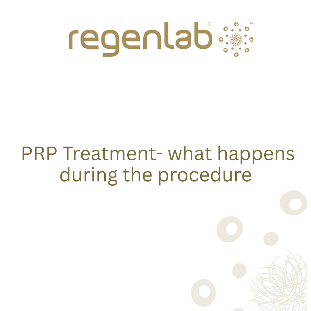 PRP treatment - what happens during the procedure