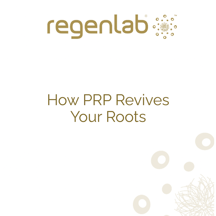 How PRP Revives Your Roots