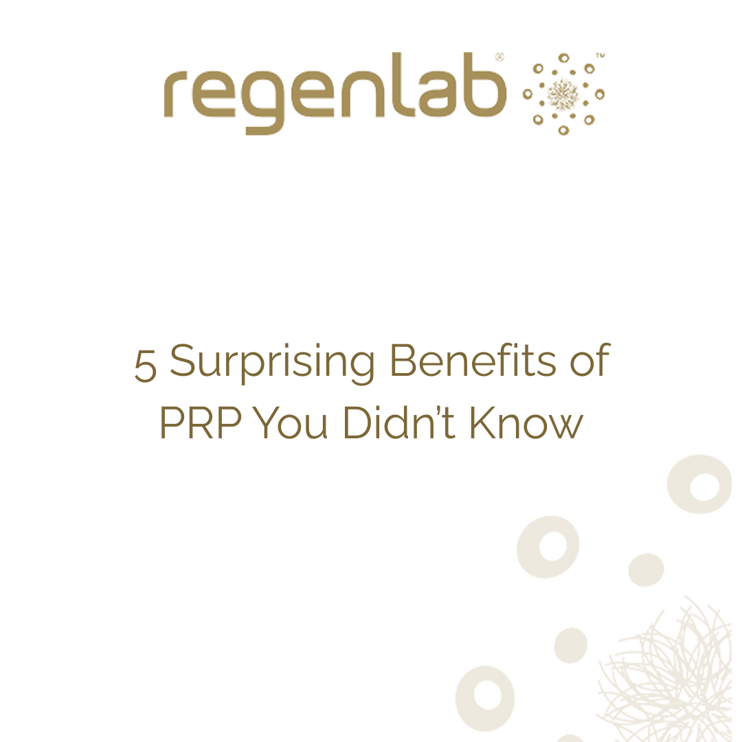 5 Surprising Benefits of PRP You Didn’t Know